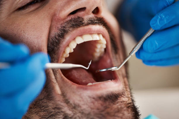 Best Weekend Emergency Dental Services in Harrah, OK